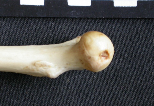 Femur: proximale part