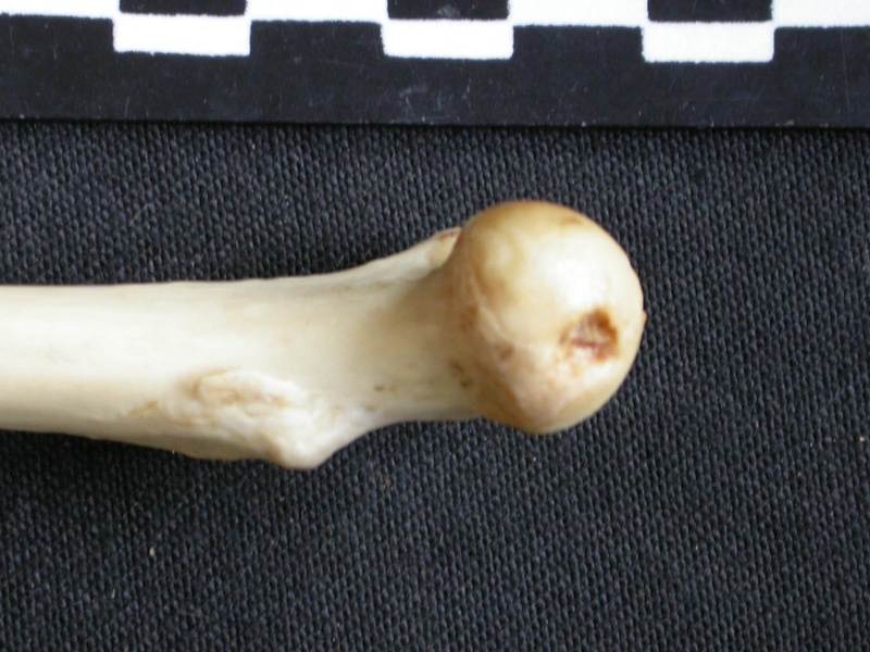 Femur: proximale part