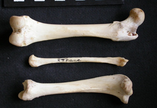  Femur, tibia and fibula