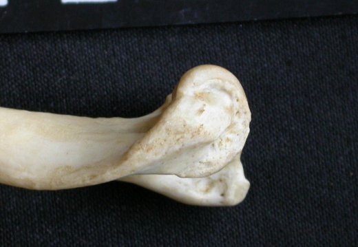 Humerus: distal part