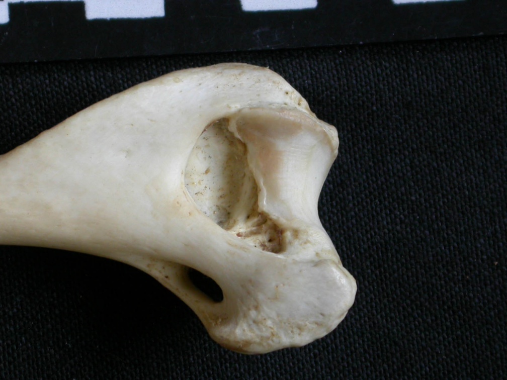 Humérus : partie distale