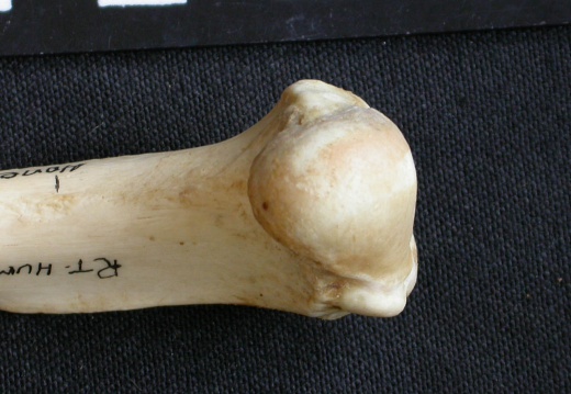 Humerus: proximale part