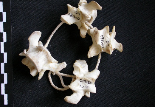 Lumbar vertebrae