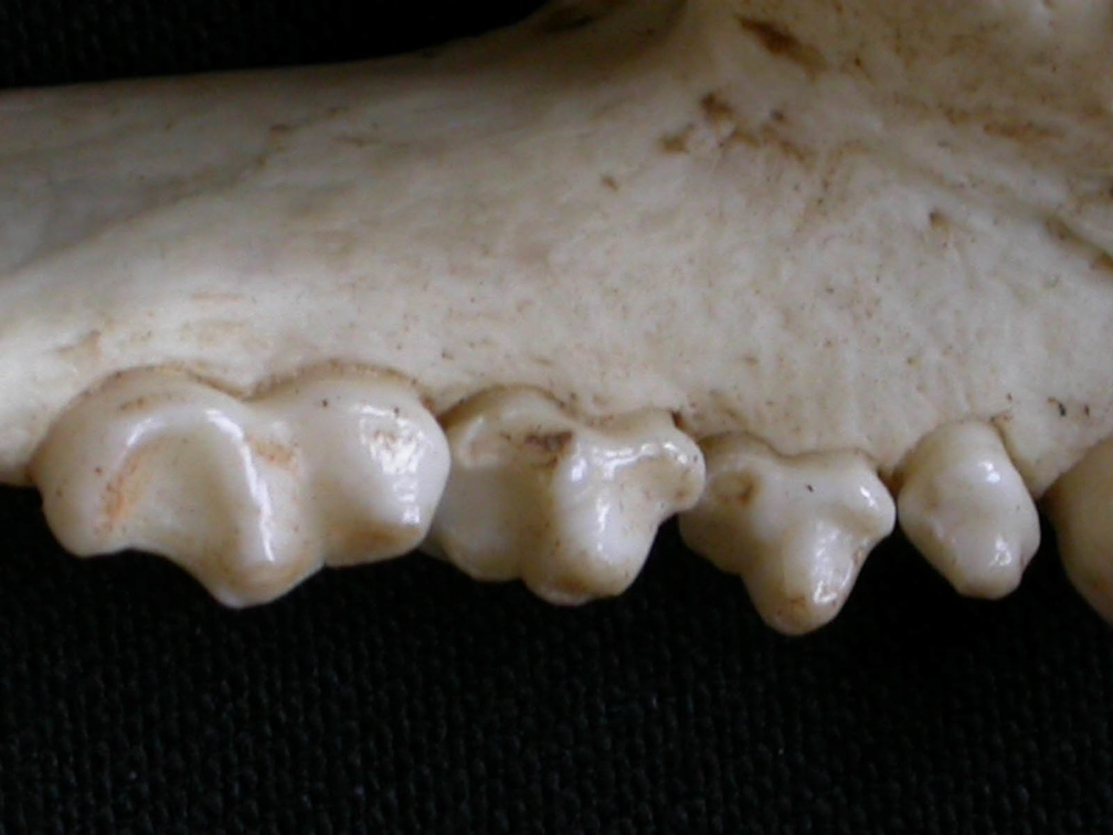 Dentition inférieure