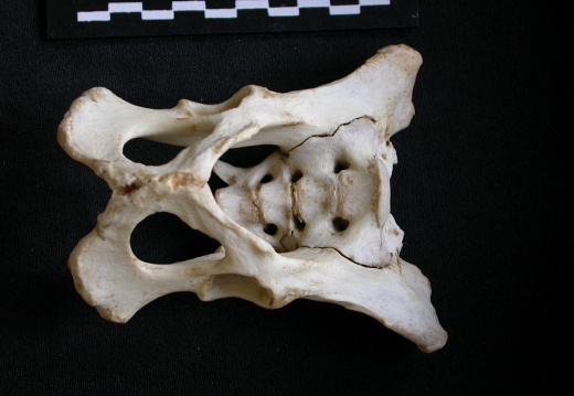 Pelvis