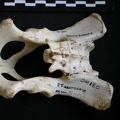 Pelvis