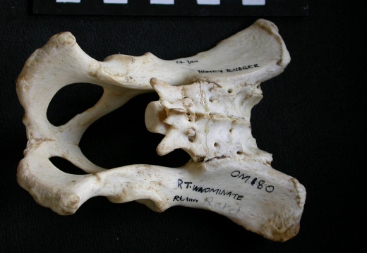 Pelvis