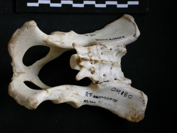 Pelvis