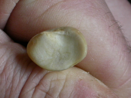 Radio : parte proximal
