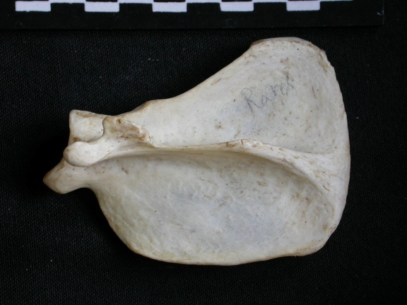 Scapula : vue latérale