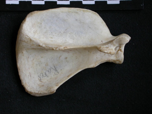 Scapula : vue latérale