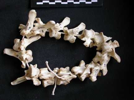 Thoracic vertebrae