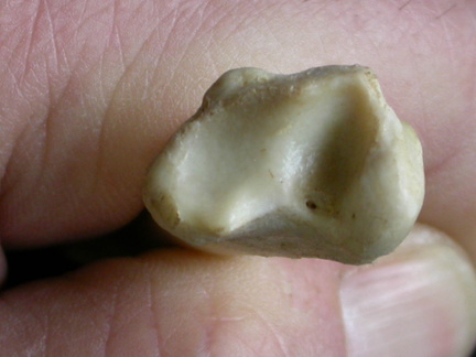 Tibia : partie distale