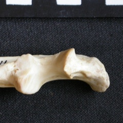  Ulna: proximale part