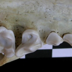 Dentition supérieure