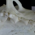 Dentition supérieure