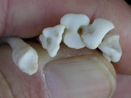 Metatarsals: proximale part