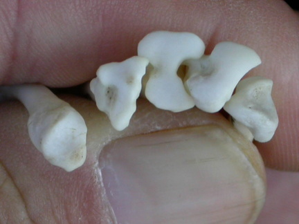 Metatarsianos : parte proximal