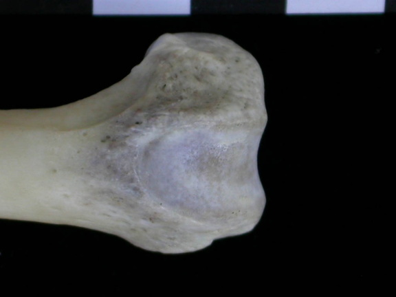 Fémur : parte distal