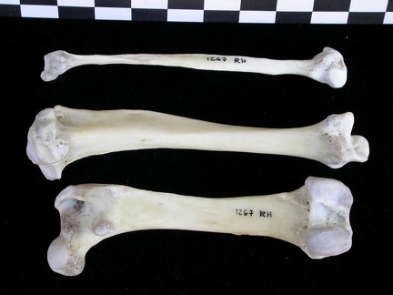  Femur, tibia and fibula