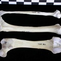 Fémur, tibia et fibula