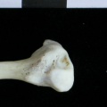 Fibula : partie distale