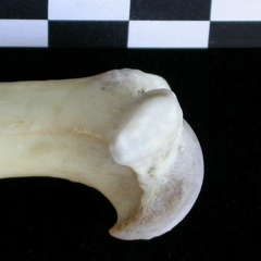 Humerus: proximale part