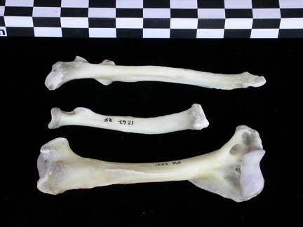 Humerus,radius and ulna