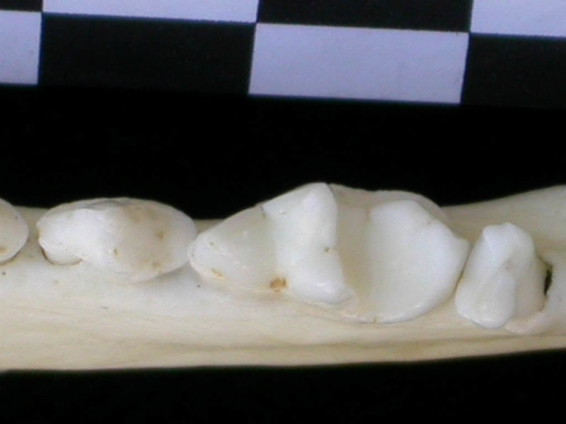 Dentition inférieure