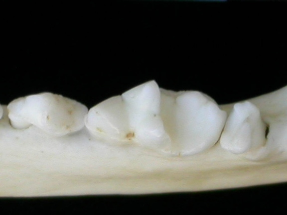 Lower teeth