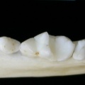 Dentition inférieure