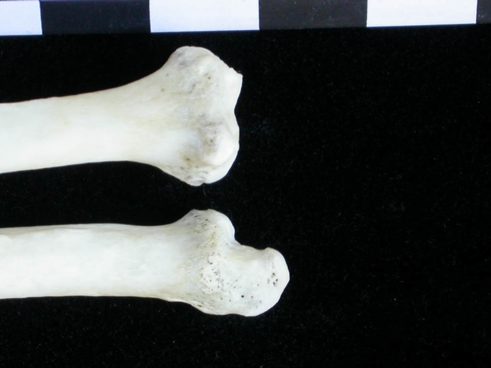 Radius et ulna : partie distale (12922 visites) Lutra lutra - Mâle - Adulte - Éléments droitsCollection : Centre d'Investigation Portugais d'Arch... Radius et ulna : partie distale