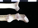 Radius et ulna : partie proximale