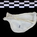 Scapula : vue latérale