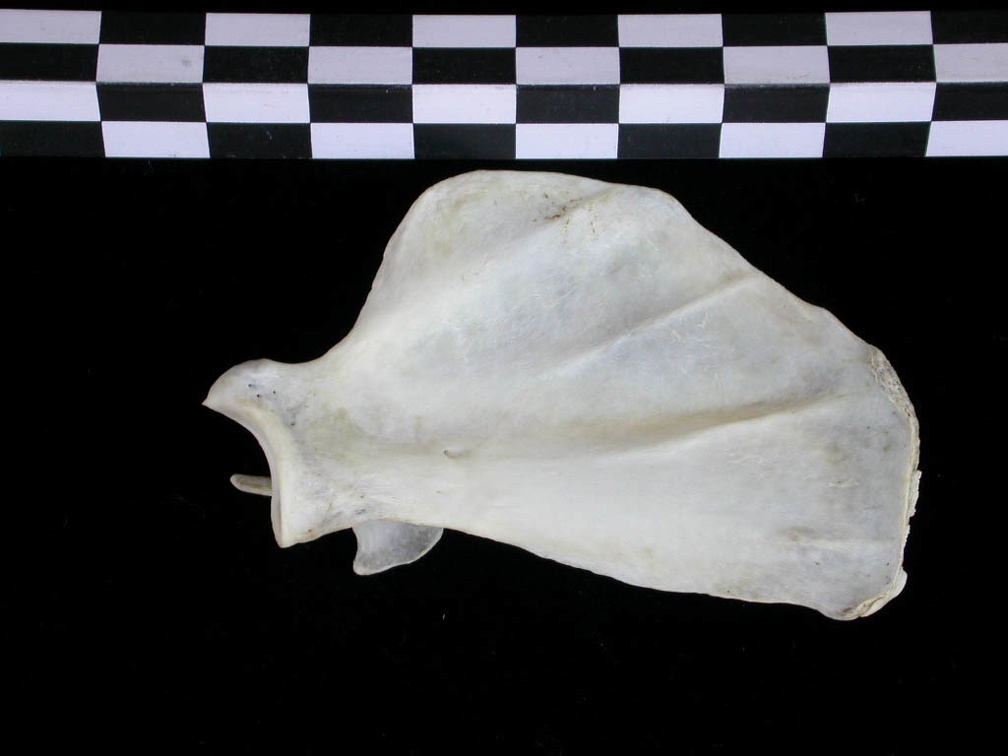 Scapula : vue médiale