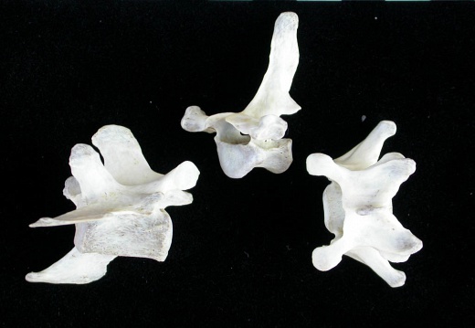 Vertebrae