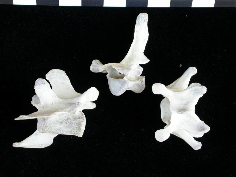 Vertebrae