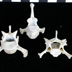 Vertebrae