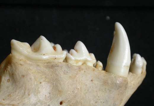 Dentition supérieure