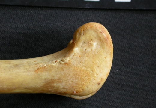 Femur: distal part