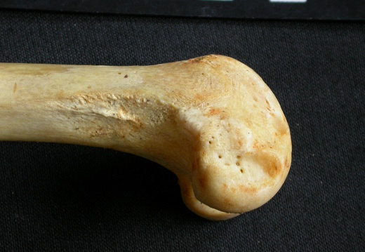 Femur: distal part