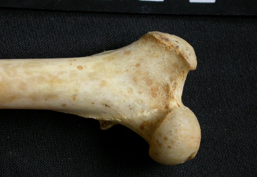 Femur: proximale part