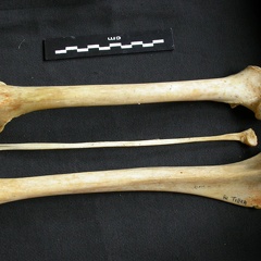  Femur, tibia and fibula