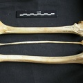 Fémur, tibia et fibula (11526 visites) Acinonyx jubatus - Femelle - Adulte - Éléments droitsCollection : Kabete laboratoire (Id:OM4193) -... Fémur, tibia et fibula