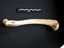 Humerus