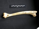 Humerus