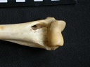 Humerus: distal part