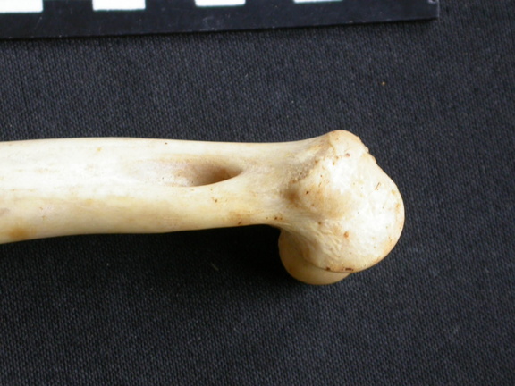 Humerus: distal part