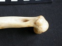 Humerus: distal part