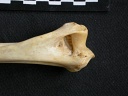 Humerus: distal part